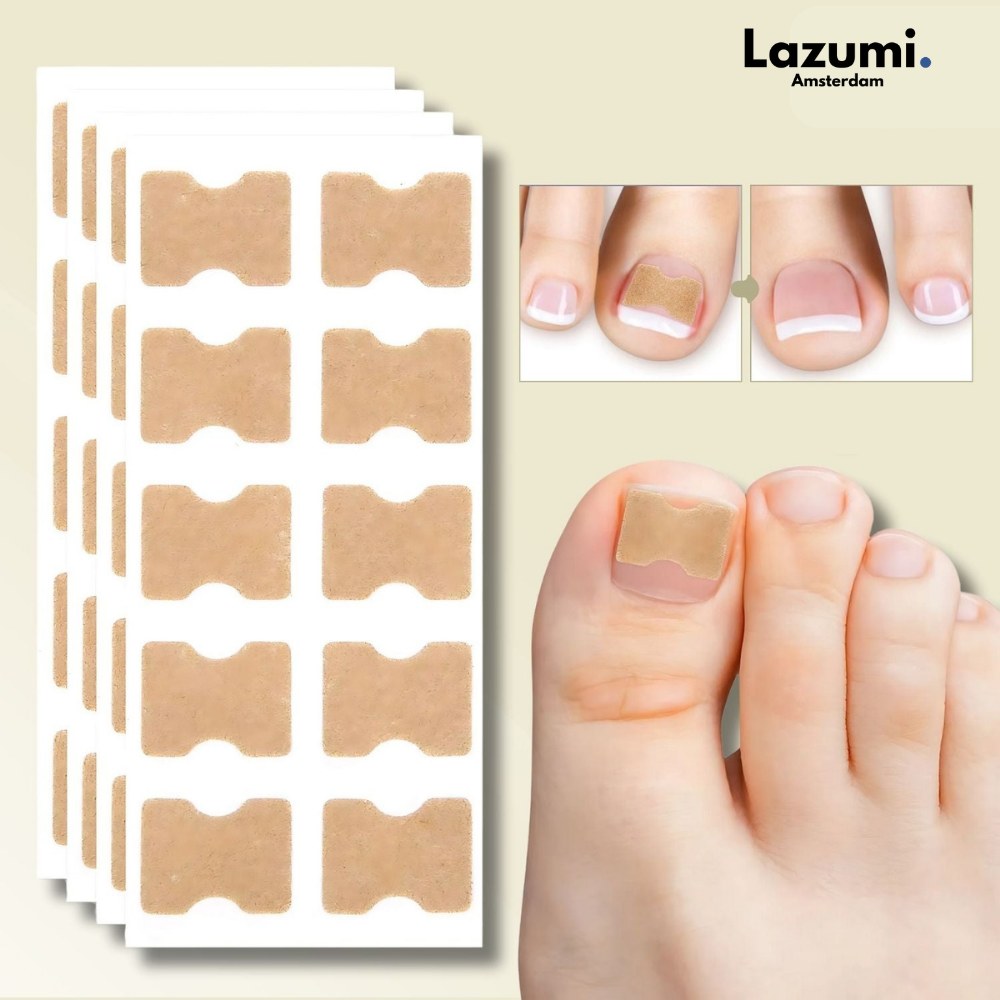 Nagelcorrector – Voor snel herstel en pijnvrije nagels