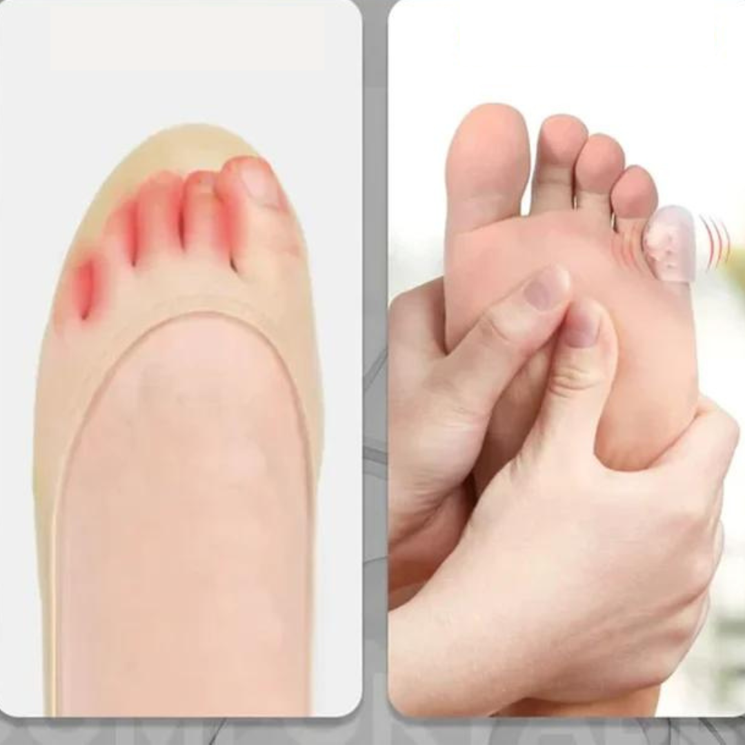 Frictuvo™ | Beschermt je tenen moeiteloos (10+10 GRATIS)